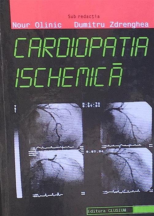 Cardiopatia ischemica