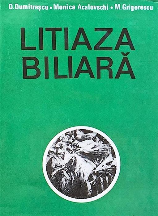 Litiaza biliara