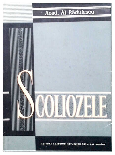 Scoliozele