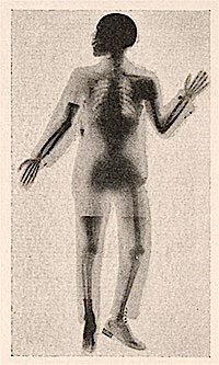 X-Ray of Dayton Miller, 1896, Library of Congress