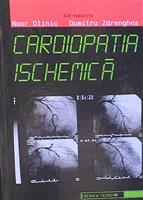 Cardiopatia ischemica