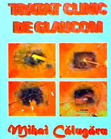 Tratat clinic de glaucom